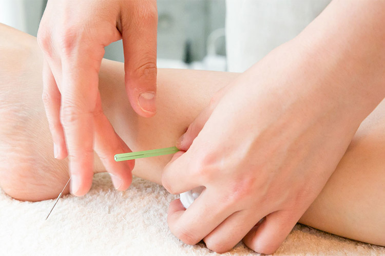 鍼灸治療について
